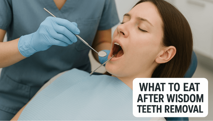 What to Eat After Wisdom Teeth Removal