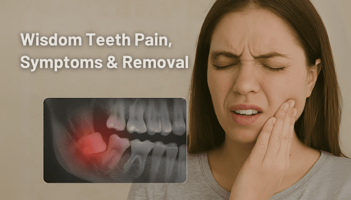 Wisdom Teeth Removal