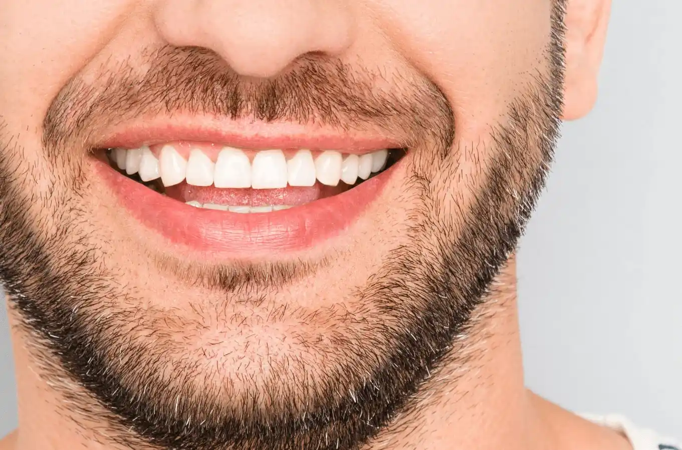 dental veneer services near me